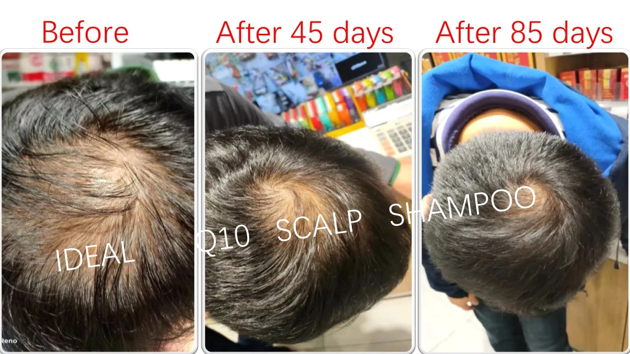 Private label shampoo oil control shampoo For Man shampoo