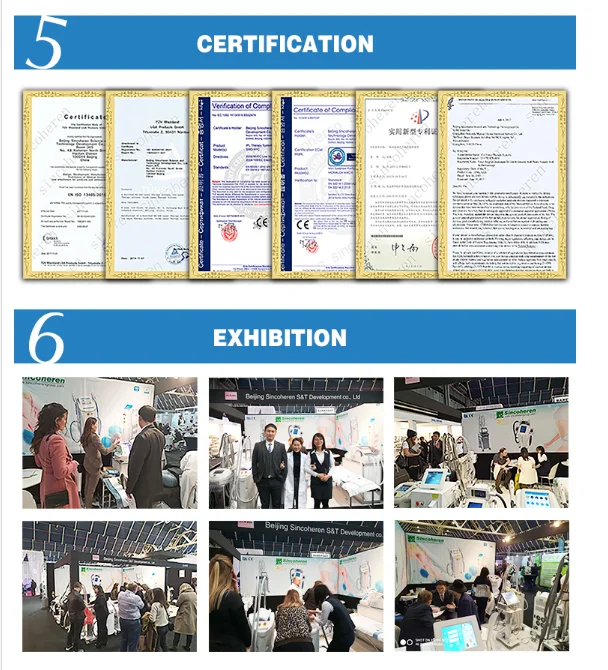 Электрическое Медицинское оборудование, Picosecond Q-switch Nd-Yag лазер, удаление татуировок, FDA, гарантированное качество