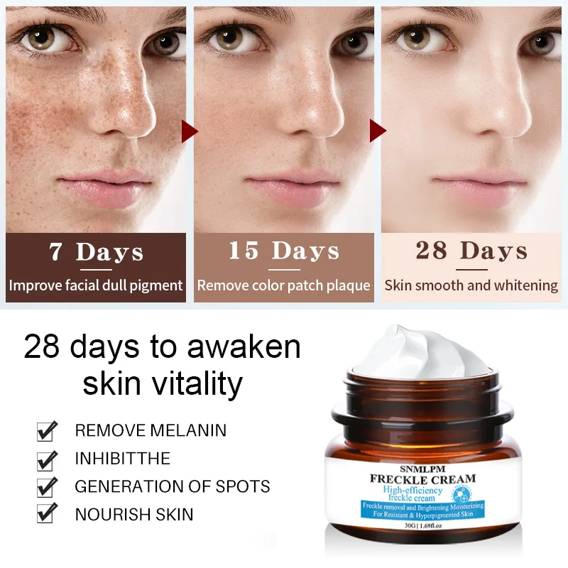 XBY 30Ml Hot Selling Freckle Melasma Removal Product High Quality Skin Whitening Cream Without Side Effects