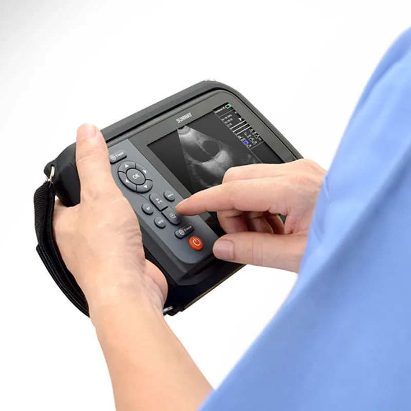 
Cheapest USB 2D Portable veterinary ultrasound machine 