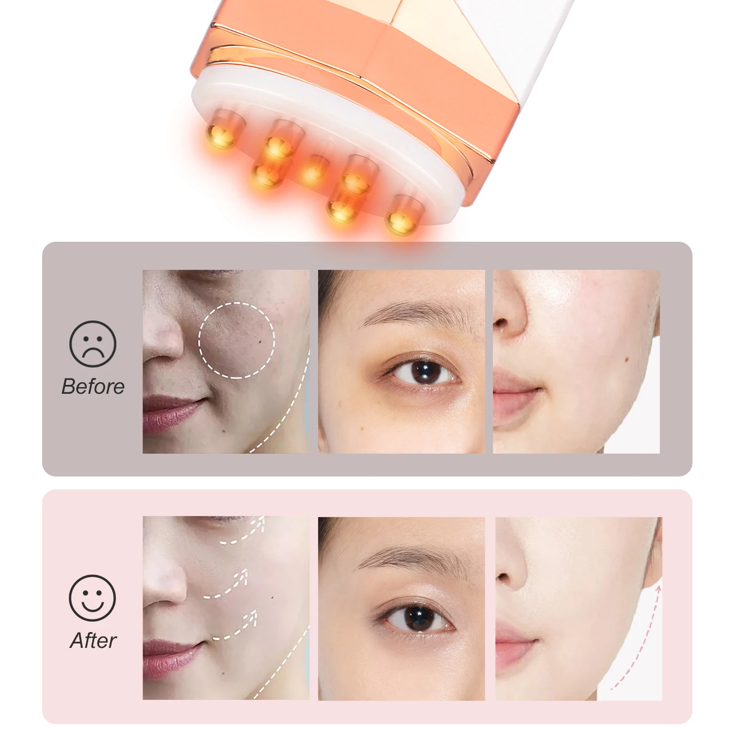 
Portable RF Home Beauty Apparatus Skin Tightening Machine Skin Care Anti Aging and Wrinkles Device 