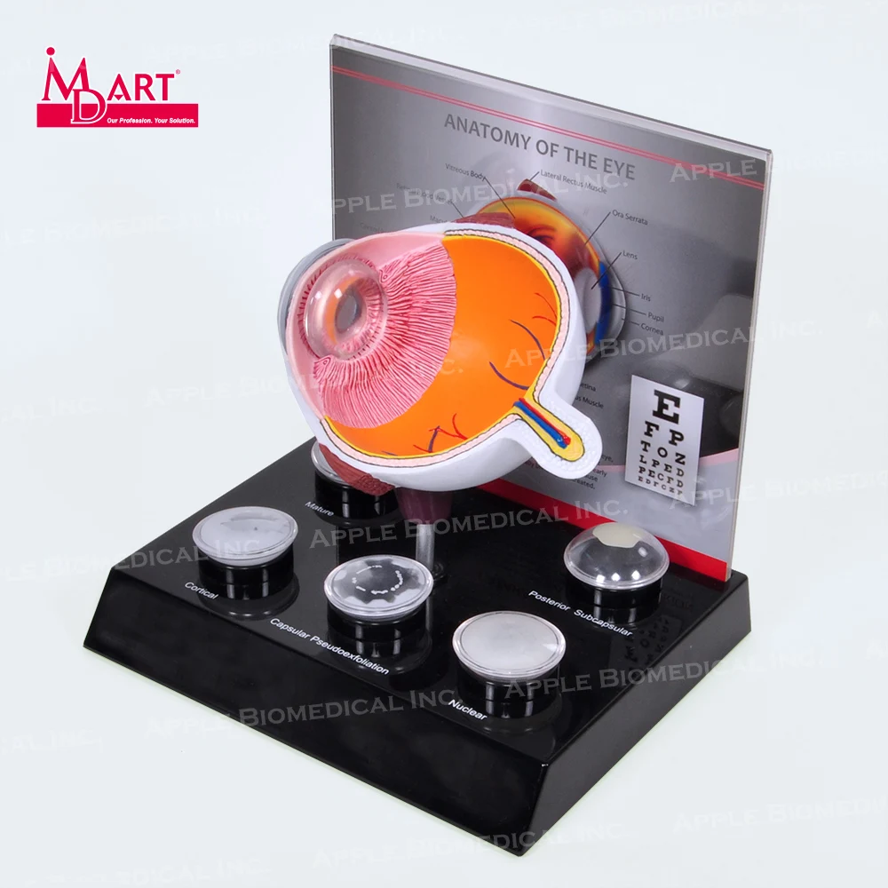 
Human eye model with replaceable disease cataract lens in medical science 