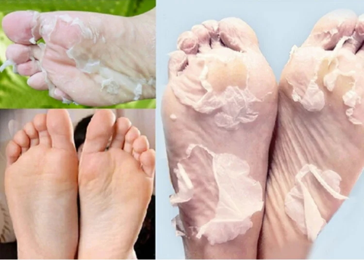 Korea OEM Hinoki Foot Peeling Mask foot peel spa socks exfoliating foot mask