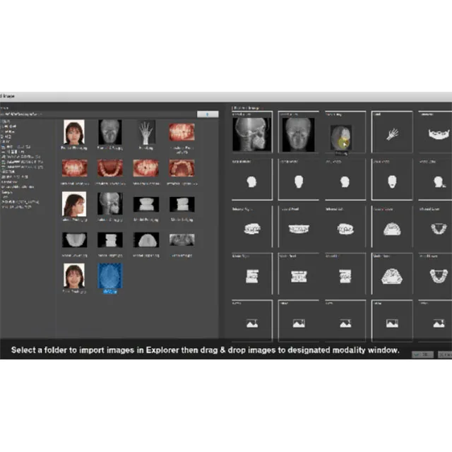 SmartCeph 2D цефалометрическая рентгеновская Диагностика от AUTOLIGN, корейский высококачественный ортодонтический Производитель Программного обеспечения