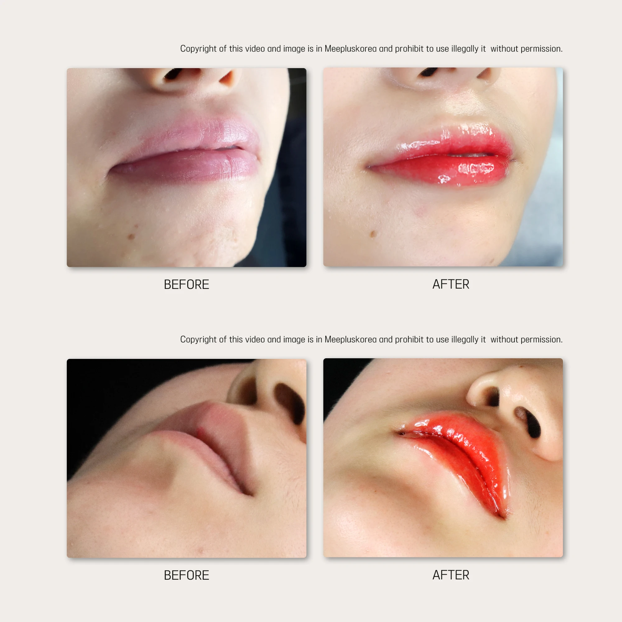 private label  BB LIP Red Korea DR.DRAWING BB Lips glow Meso Serum For Semi Permanent BB Makeup Lip Gloss MTS  OEM logo