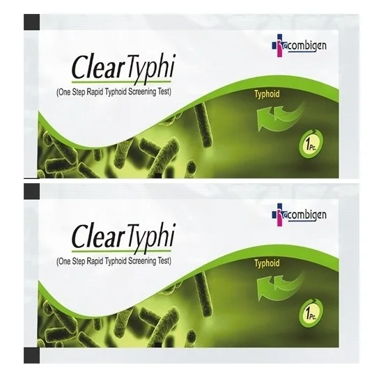 
typhoid igg/igm test 