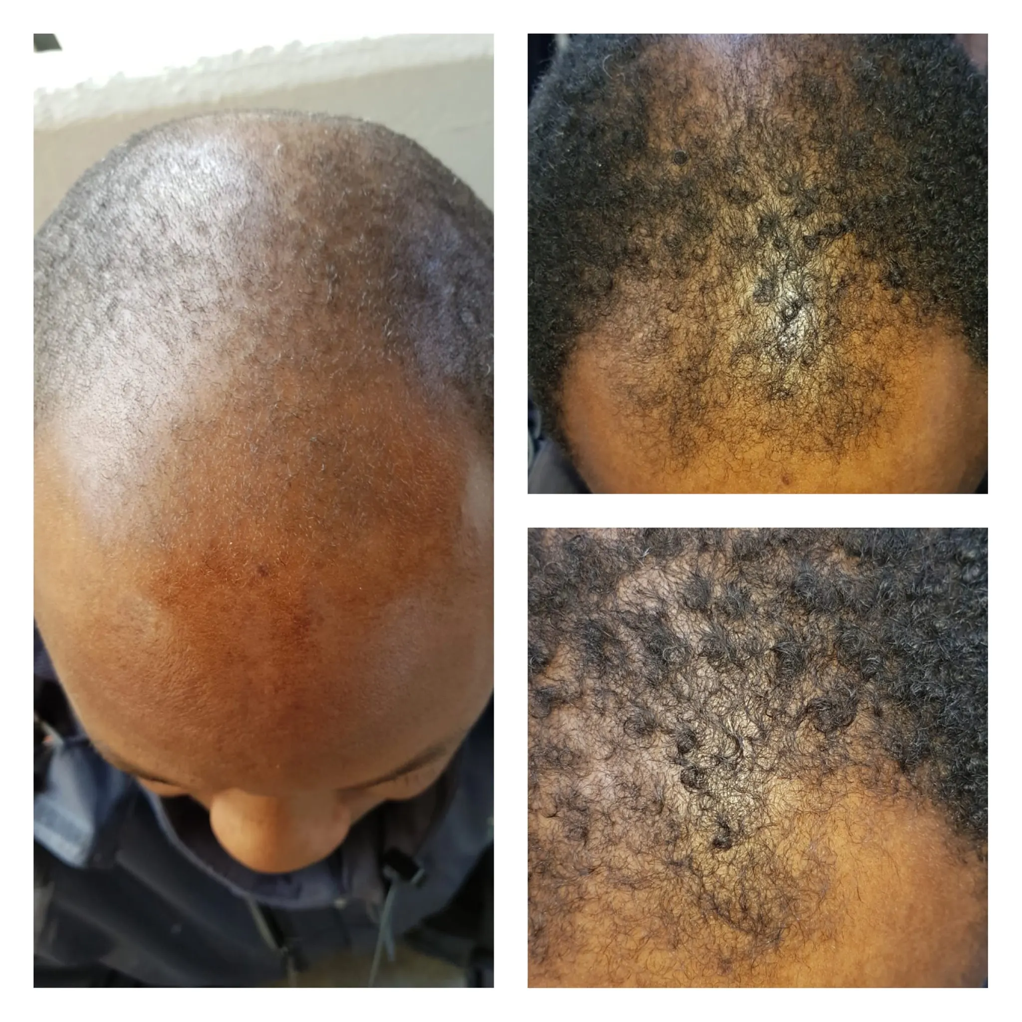 Neo Hair Lotion Hair Serum Hair Loss Genuine by Green Wealth Thailand