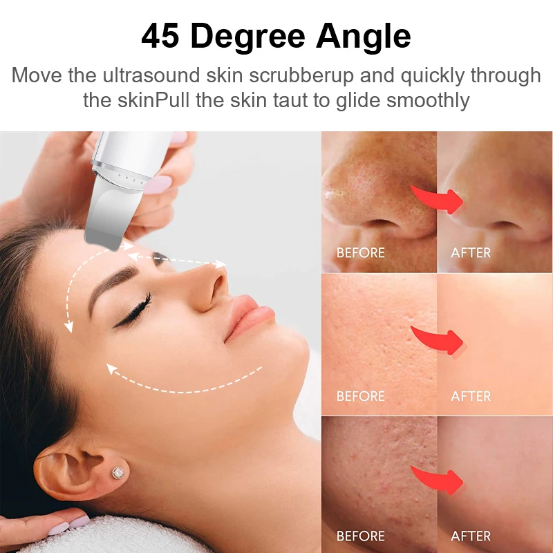 2022 Best Selling Ultrasonic Skin Scrubber Deep Facial Cleaning Machine Black Head Remover Face Spatula Pores Cleaner