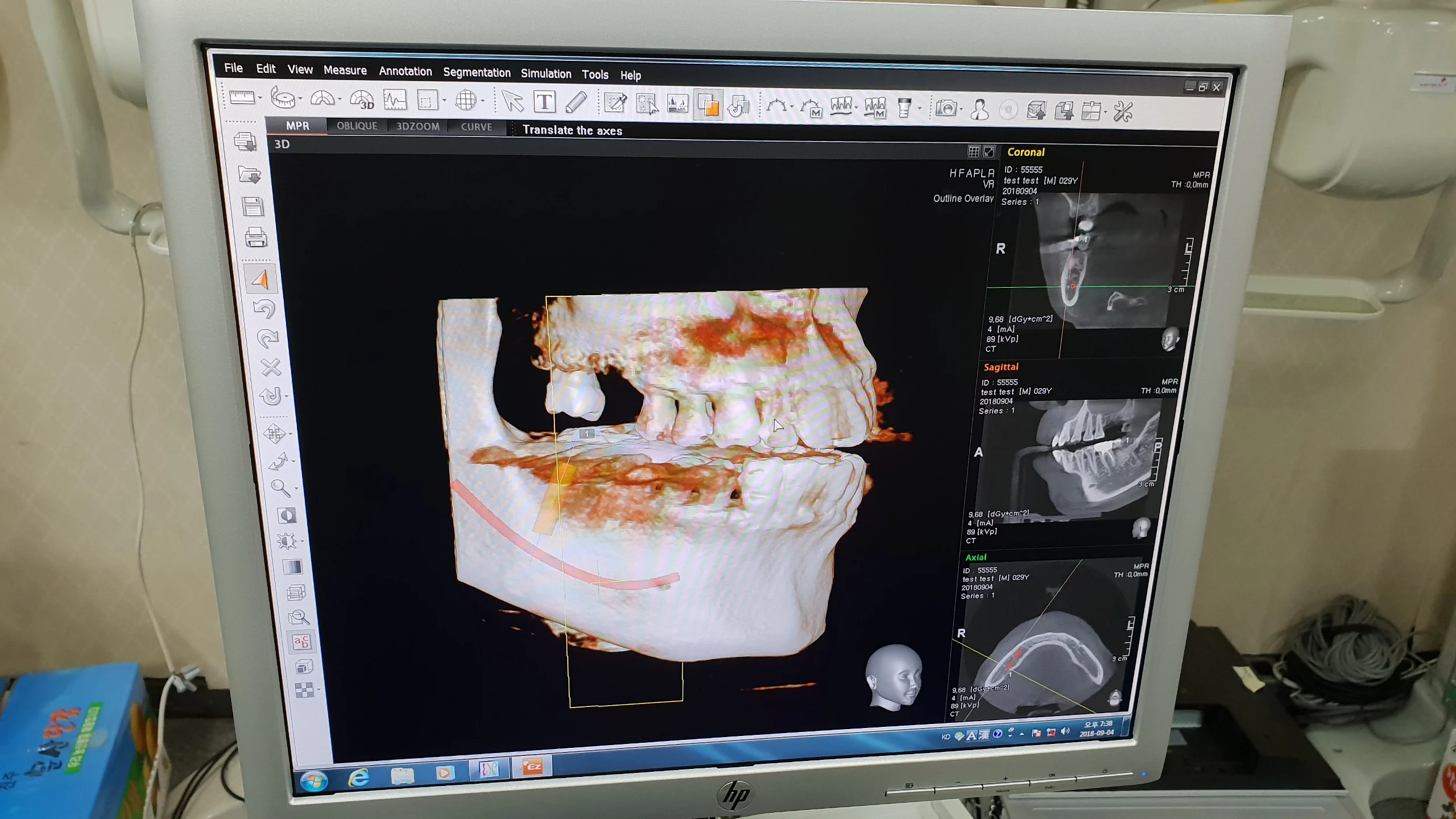 USED/REFURBISHED DIGITAL CT PANORAMIC DENTAL X-RAY SYSTEM w/wo CEPHALO UNIT