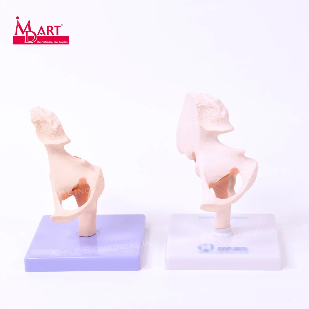 
Sample sale human hip model with transient osteoporosis for medical science 