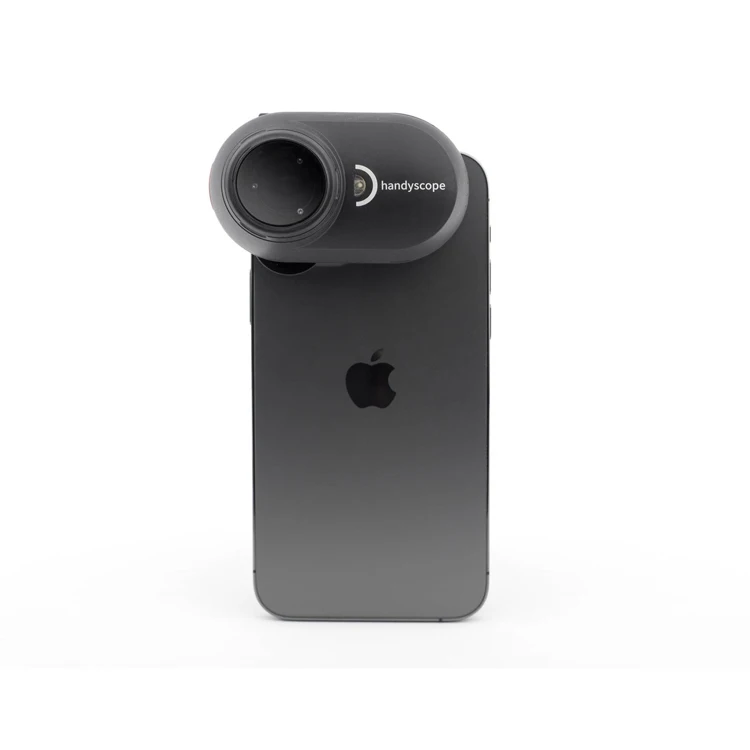 New mobile dermatoscope is compatible with any iOS or Android phone or tablet price mini skin analyzer looking melanoma