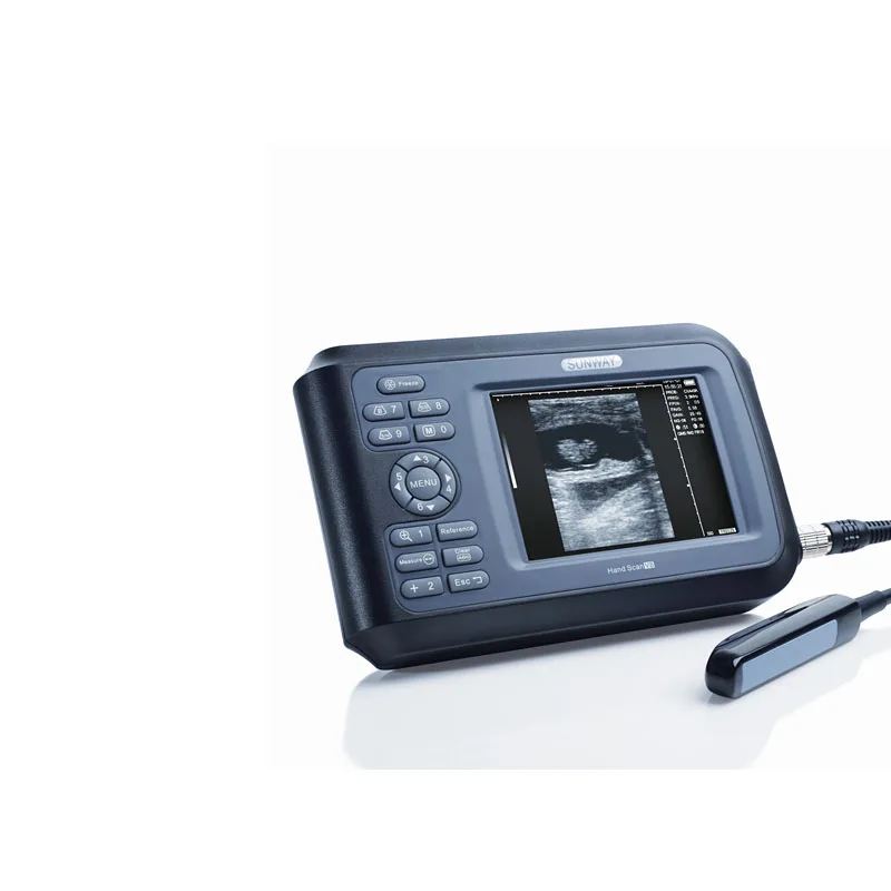 
Cheapest USB 2D Portable veterinary ultrasound machine 