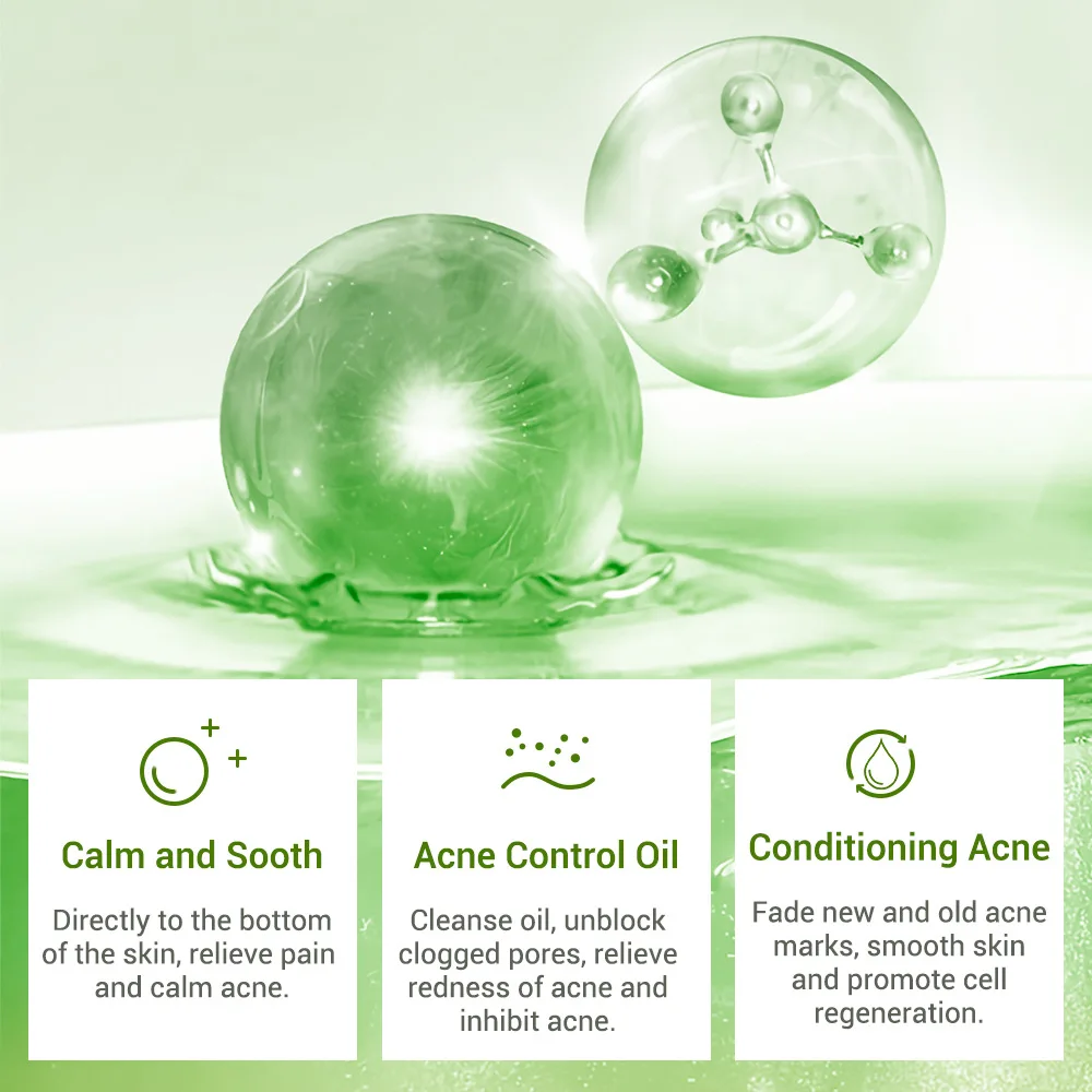 
ACNE TREATMENT TONER Natural Plant Extract whitening acne treatment face toner for oil control 