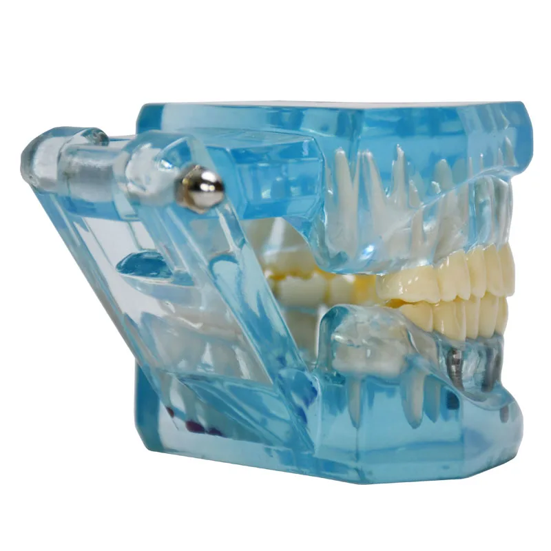 Производство изготовление на заказ прозрачная для взрослых патологическая Стоматологическая модель обучения зубам демонстрация зубных имплантов