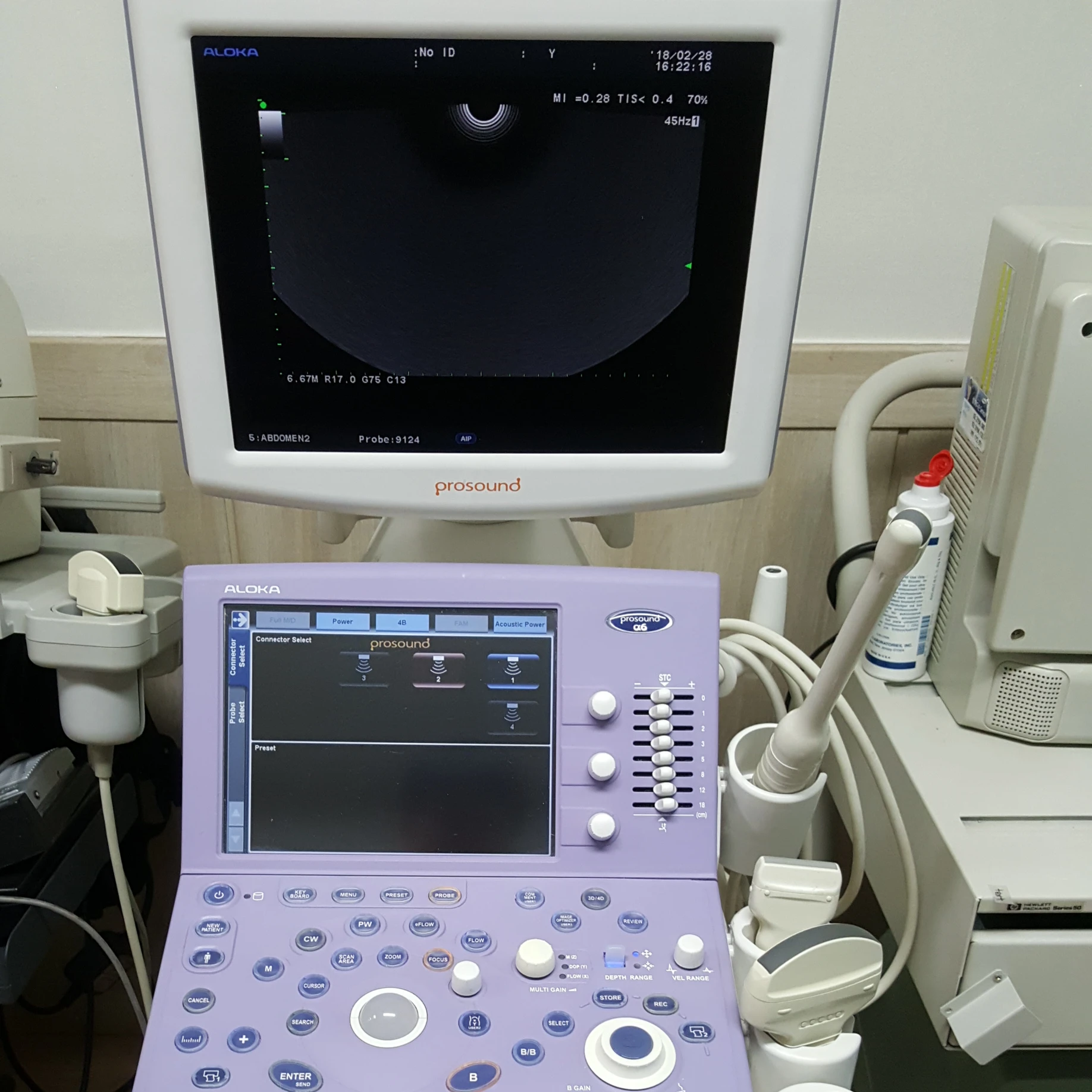 
 Б/у/отремонтированный ALOKA PROSOUND ALPHA6 / Alpha7  