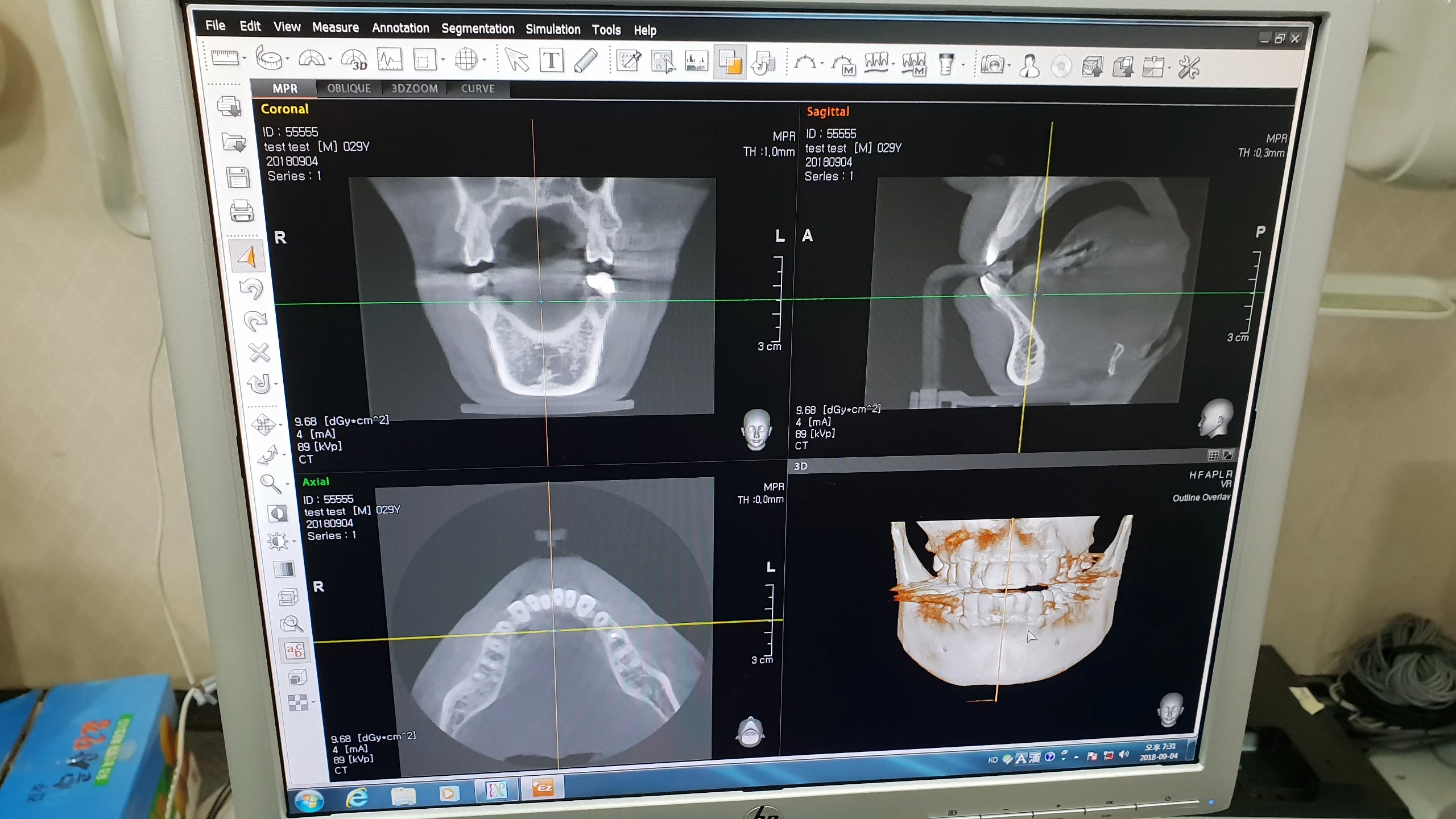 USED/REFURBISHED DIGITAL CT PANORAMIC DENTAL X-RAY SYSTEM w/wo CEPHALO UNIT