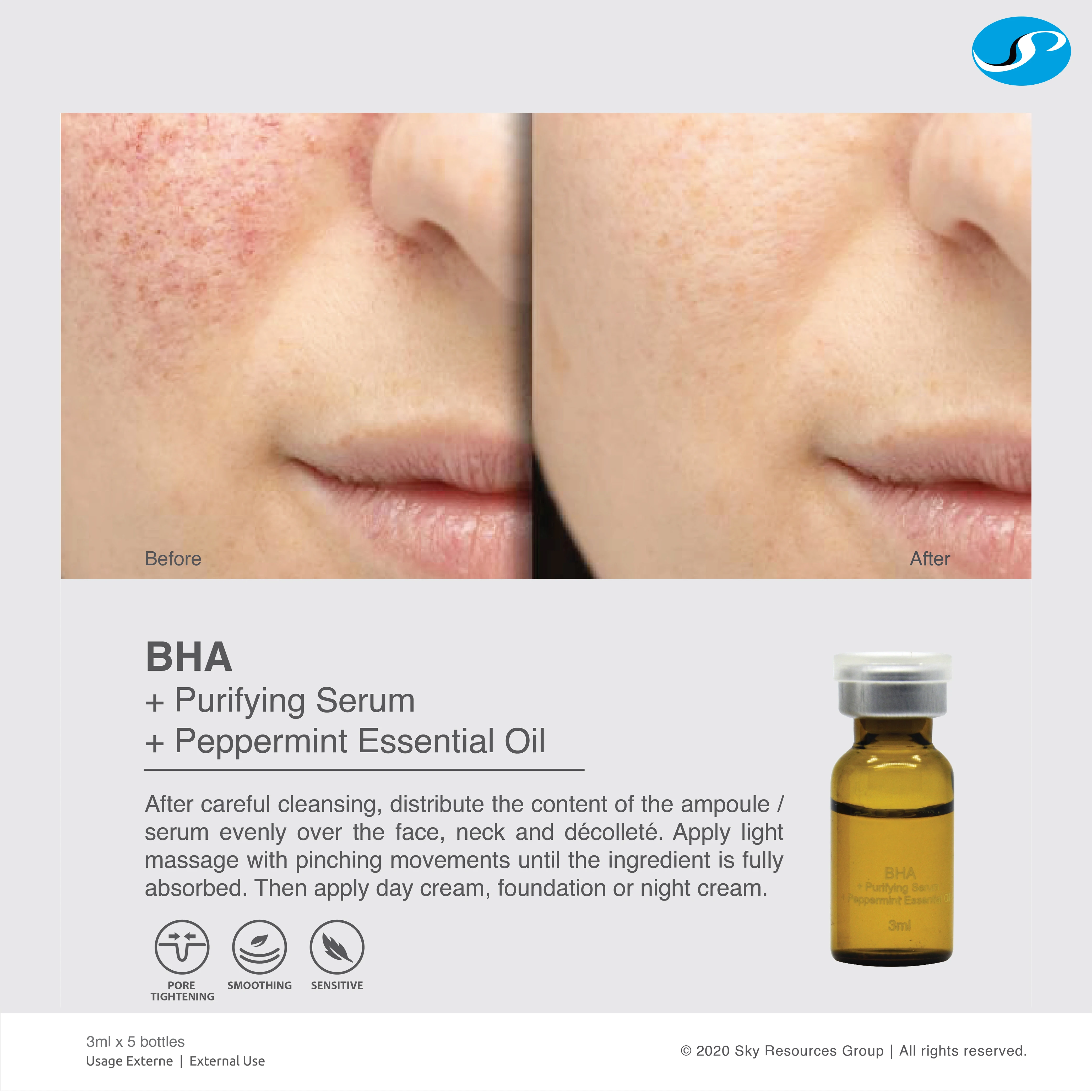 Pore Tightening Anti acne treatment sebum control BHA Purifying Serum Ampoule with salicylic acid peel	best for acne prone skin