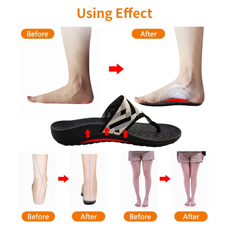 Flat Feet Eva Orthopedic  Orthotic Flip Flop
