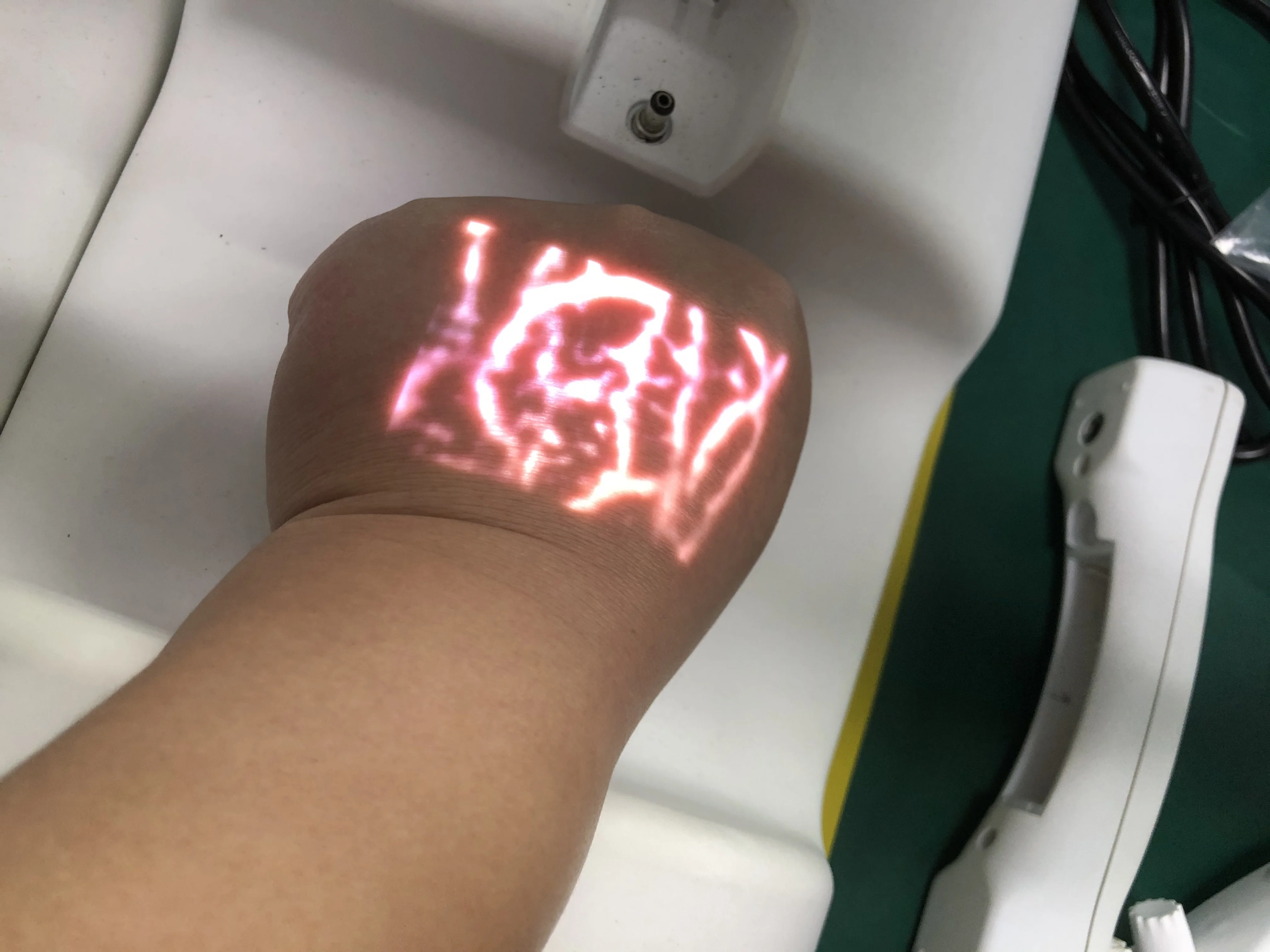 
cheap price US patent Biochemical projecting hospital Veinview 