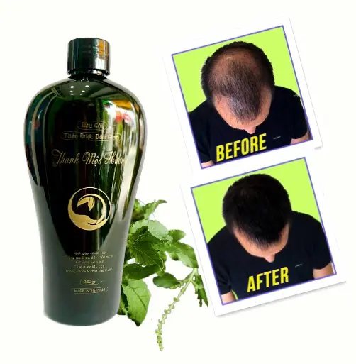 Vietnam Herbs Extract Shampoo Hair Strengthening Treatment Herbal Shampoo Prevent Hair Loss Shampoo and Conditioner