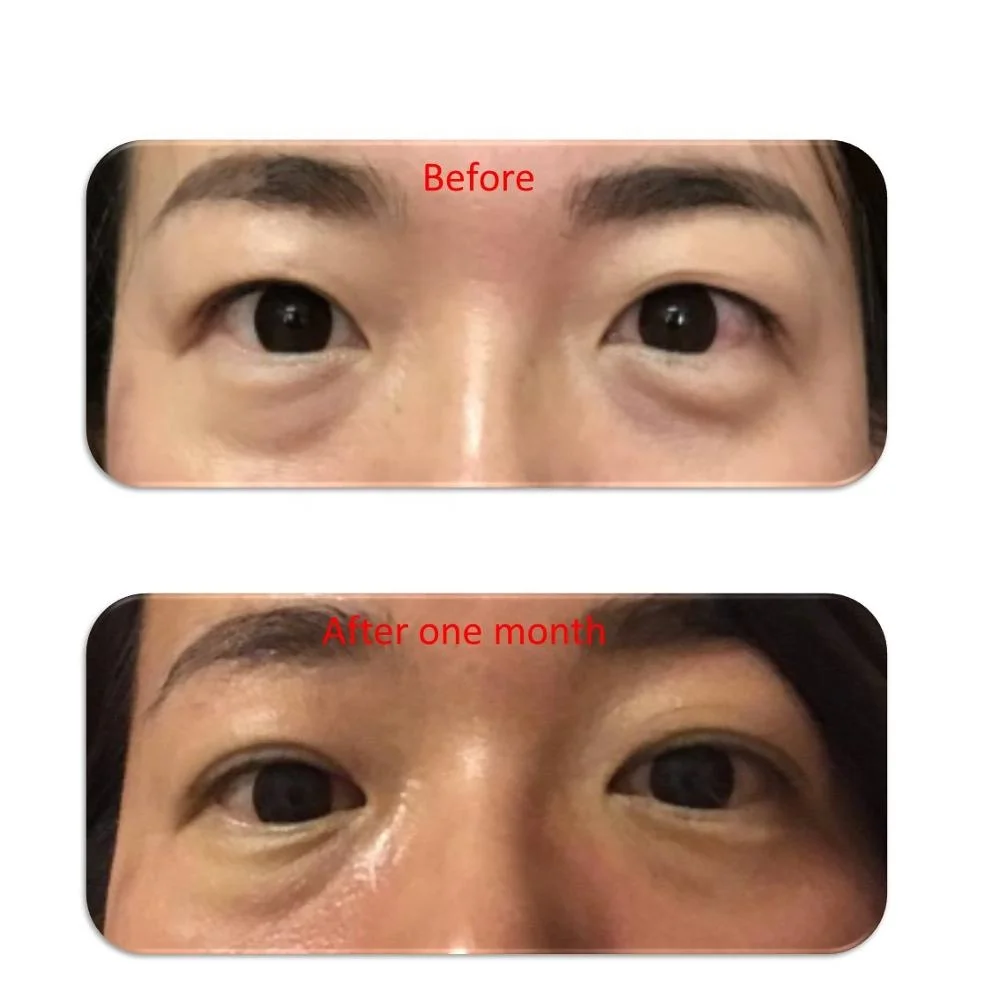
Anti fine lines eye serum for Private label collagen eye gel 