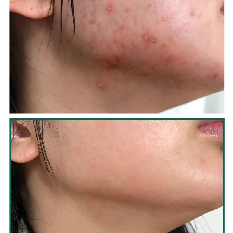 
[SomeByMi] AHA/BHA/PHA 30 DAYS MIRACLE SERUM 