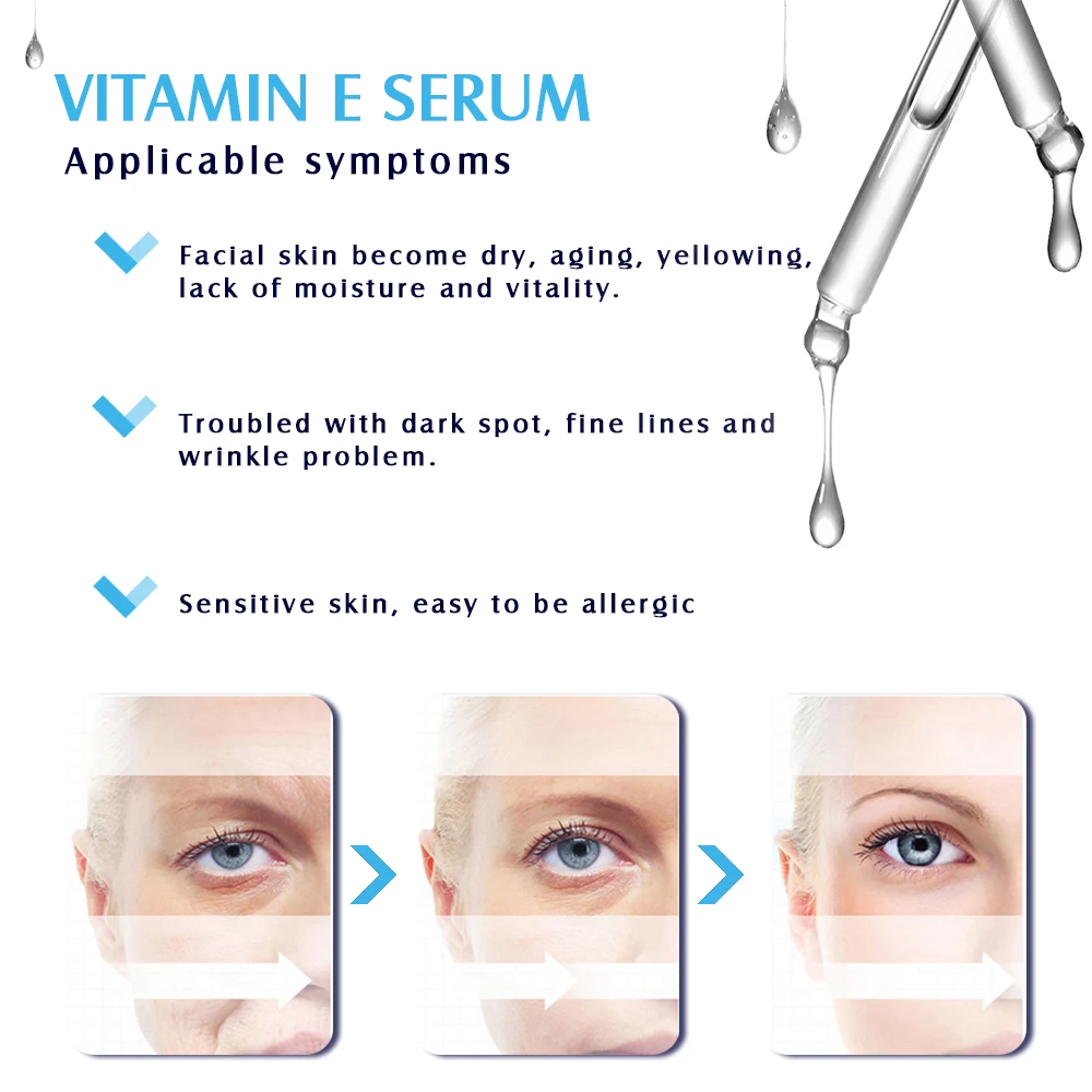Private Label Factory Supply Desalination wrinkles Anti aging arbutin serum 30ML vitamin e serum