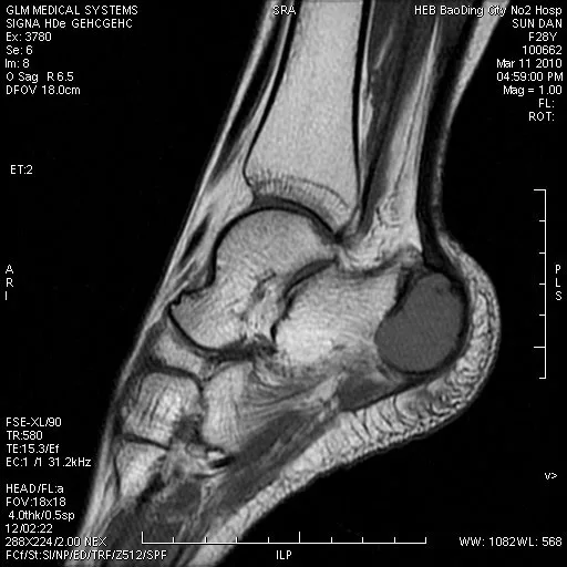 
agfa dt2b medical thermal film for x-ray image output printing by laser printer from china direct sale 