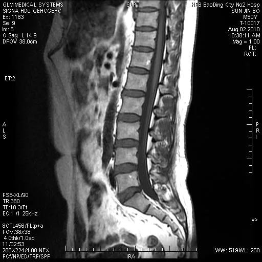 fuji dihl medical radioactive dry imaging film for thermal printer