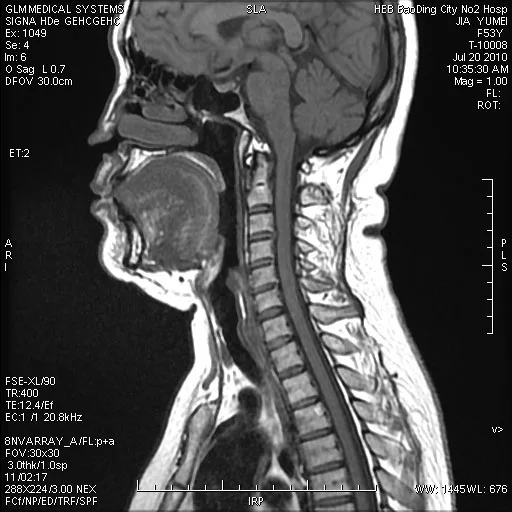 fuji dihl medical radioactive dry imaging film for thermal printer