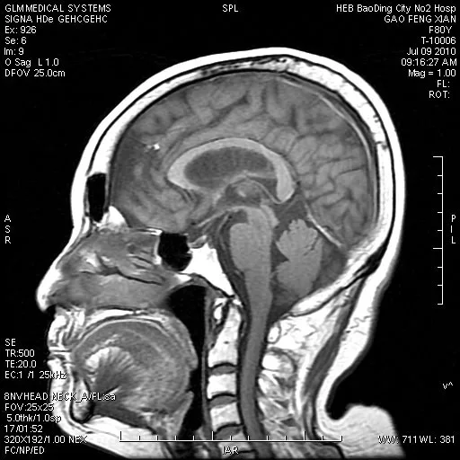 Синяя 8*10 дюймов 20*25 см сухая медицинская рентгеновская МРТ ct цифровая пленка для теплового принтера imager Agfa 5300/5302/5500/5503 Fuji 3500 2000
