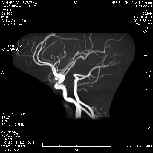 Синяя 8*10 дюймов 20*25 см сухая медицинская рентгеновская МРТ ct цифровая пленка для теплового принтера imager Agfa 5300/5302/5500/5503 Fuji 3500 2000