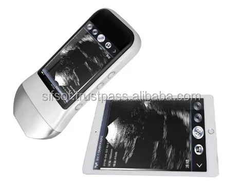 Wireless High Quality Linear Probe Portable Connected Ultrasound Scanner, , WiFi Ultrasound 12MHz, SIFULTRAS-5.4