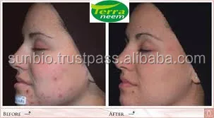 Natural Insecticide Aza natural way of cold processing method with high Azadirachtin content of minimum 3500ppm to4000 p