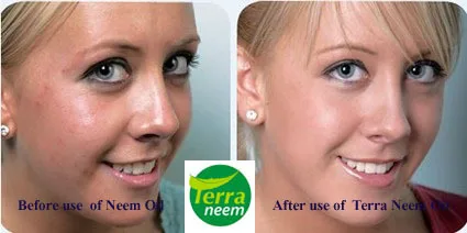 Neem Oil Pest Control natural way of cold processing method with high Azadirachtin content of minimum 3500ppm to4000 p