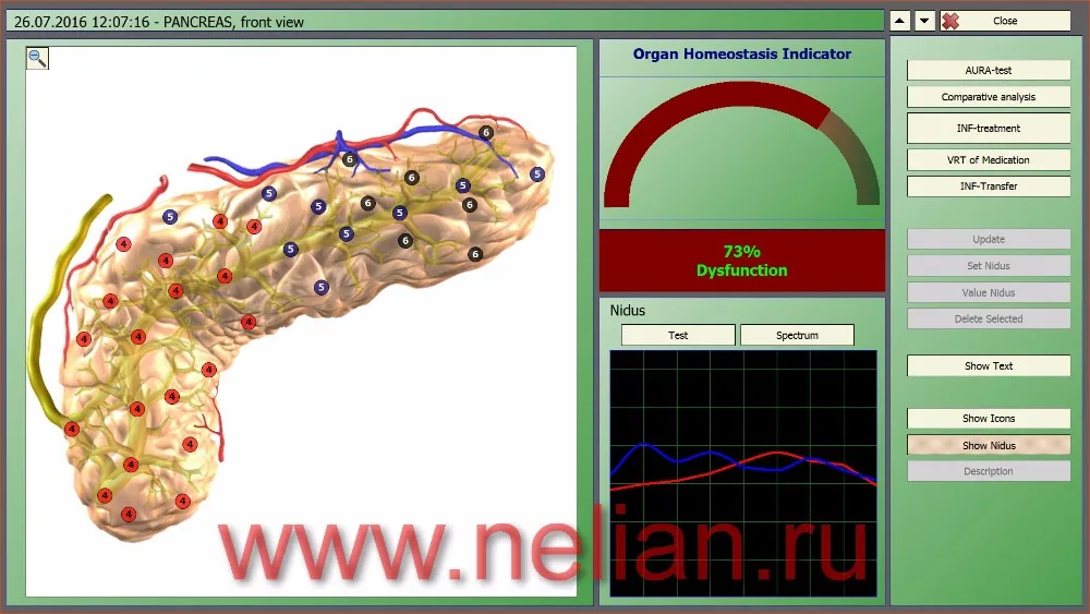 d2-analysis-with-homeostasis-indicator-pancreas-73