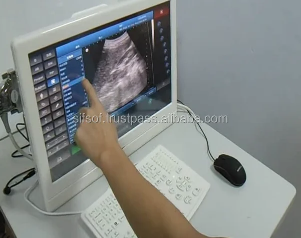 Popular Promotional Portable Veterinary Ultrasound Goat, Portable Ultrasound Scanner, SIFULTRAS-4.1