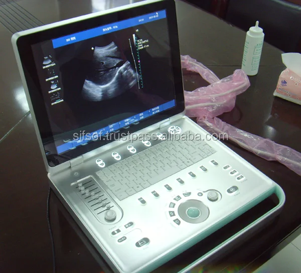 Usb Ultrasound Scanner, Portable Ultrasound Scanner, 3D Ultrasound SIFULTRAS-6.2