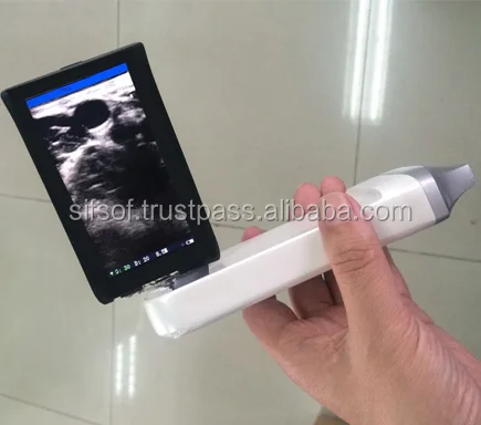 Wireless High Quality Linear Probe Portable Connected Ultrasound Scanner, , WiFi Ultrasound 12MHz, SIFULTRAS-5.4