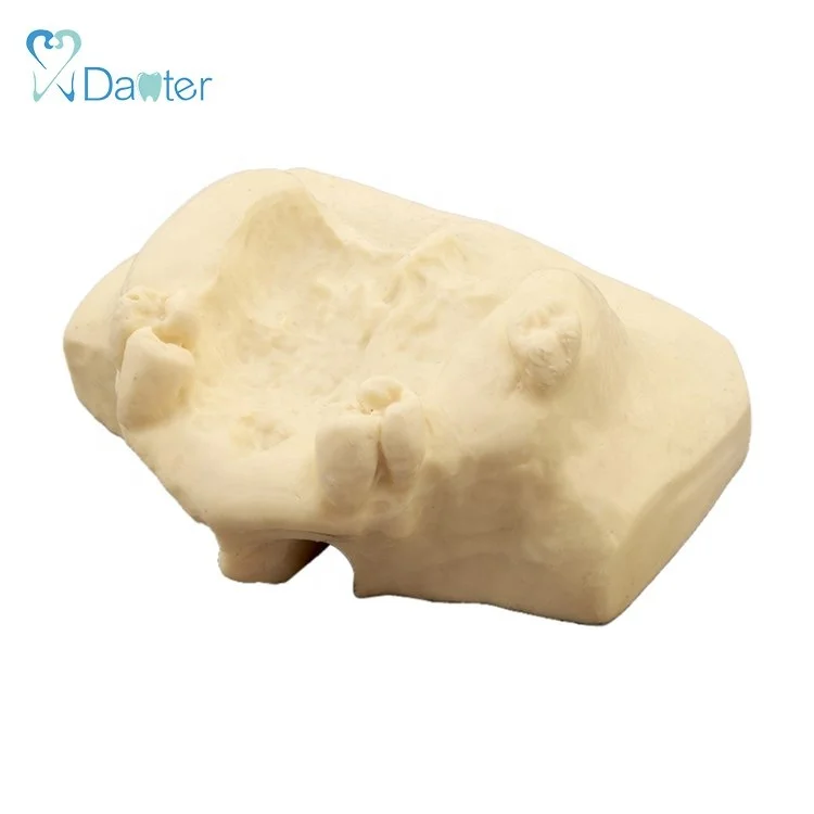 Лидер продаж обучающий пропущенные зубы зубной имплантат моторная тренировка распродажа