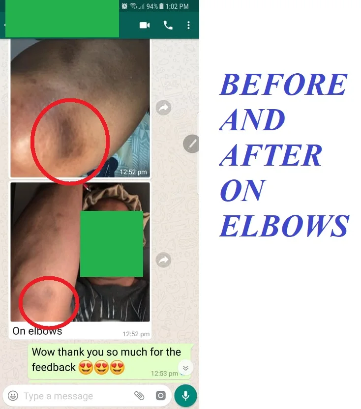 Skin Whitening Cream Magical Glow Fast Cream 10g, 500g, 1000g