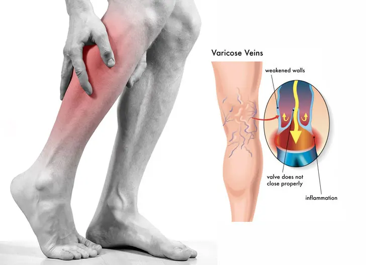 Microcirculation and anticoagulant Diosmin - vitamin supplements