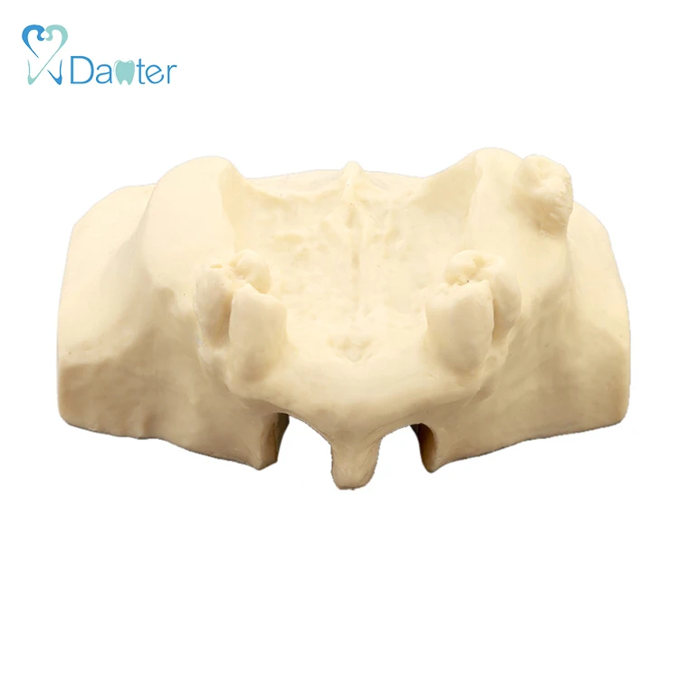 Лидер продаж обучающий пропущенные зубы зубной имплантат моторная тренировка распродажа