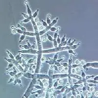 
Trichoderma Viride Powder Plant Protection Bio Fertilizer 