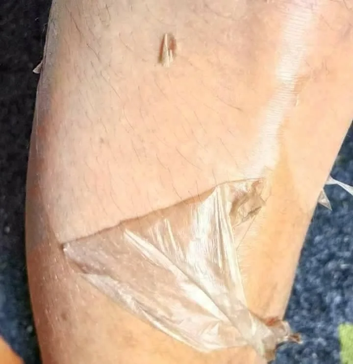 
Most Effective Yellow Peeling Oil 1 Liter Lowest Price 