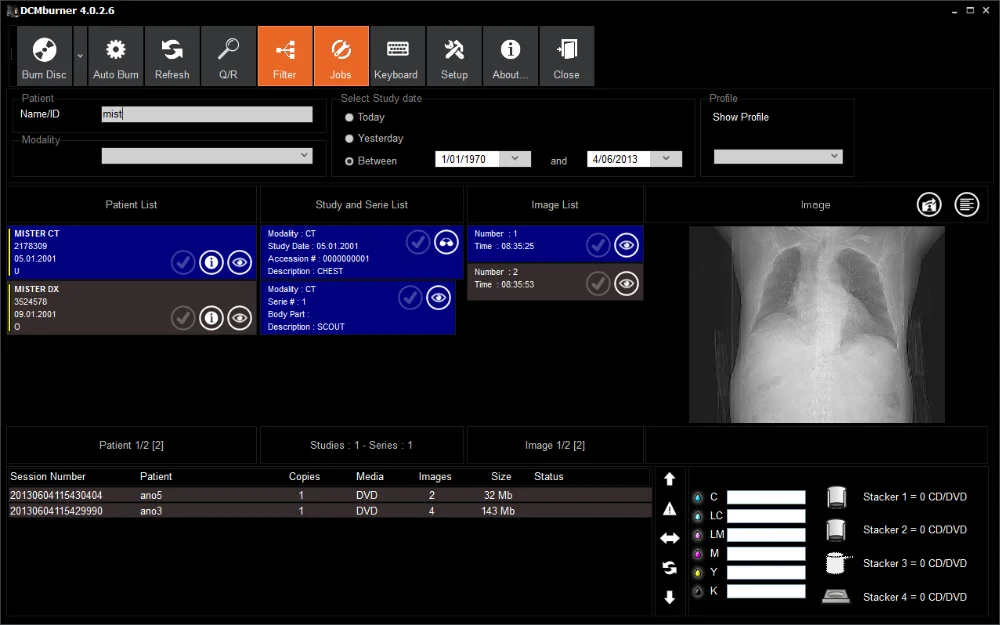 Automated 2-drive CD DVD Duplicator & Printer for Medical DICOM Images w/ Built-In PC & 220 Disc Capacity
