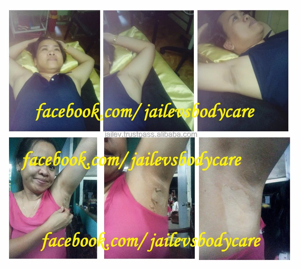 
Effective Whole Body Skin Peeling Scar Remover Kit 240ml 