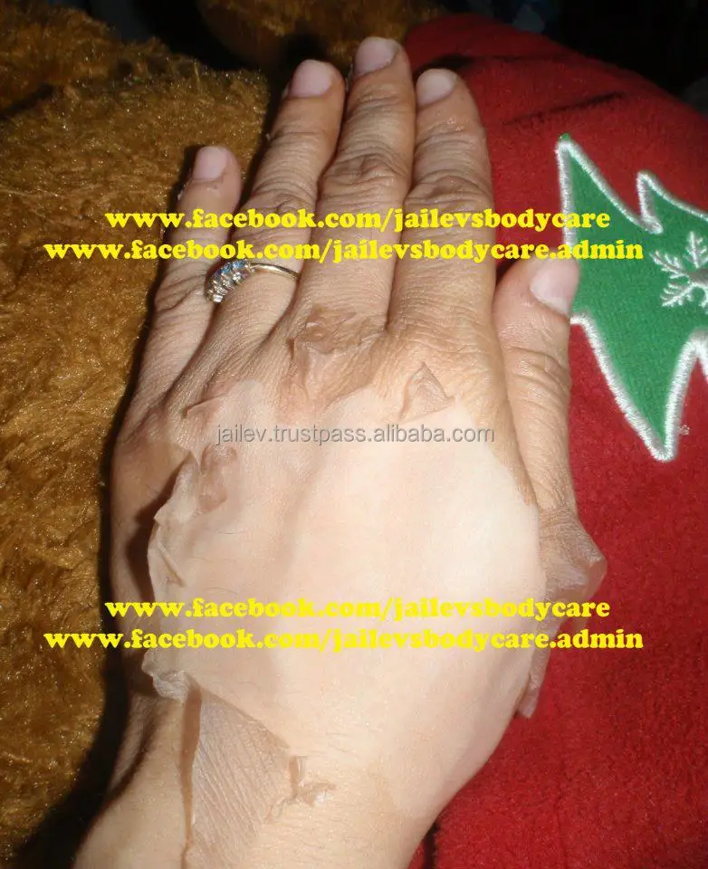 
Effective Whole Body Skin Peeling Scar Remover Kit 240ml 