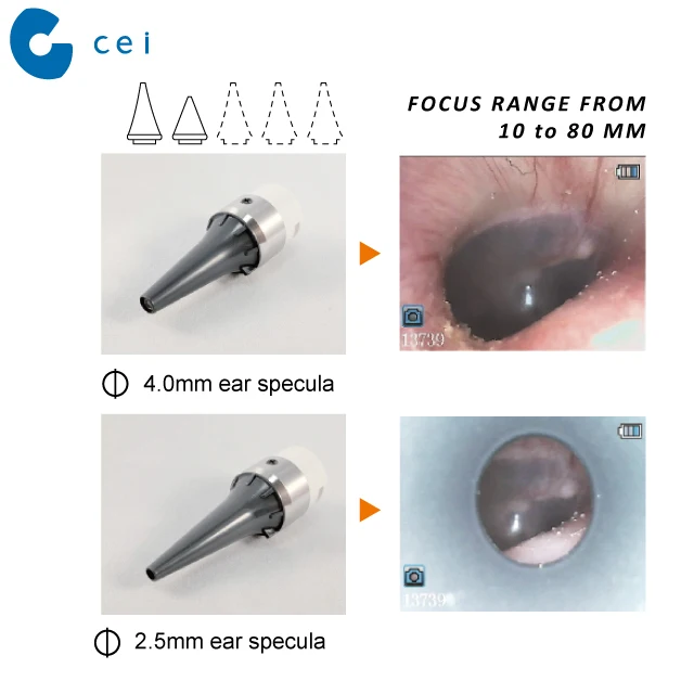 High Resolution Ear Camera Otoscope Ear Speculum Diagnostic Set