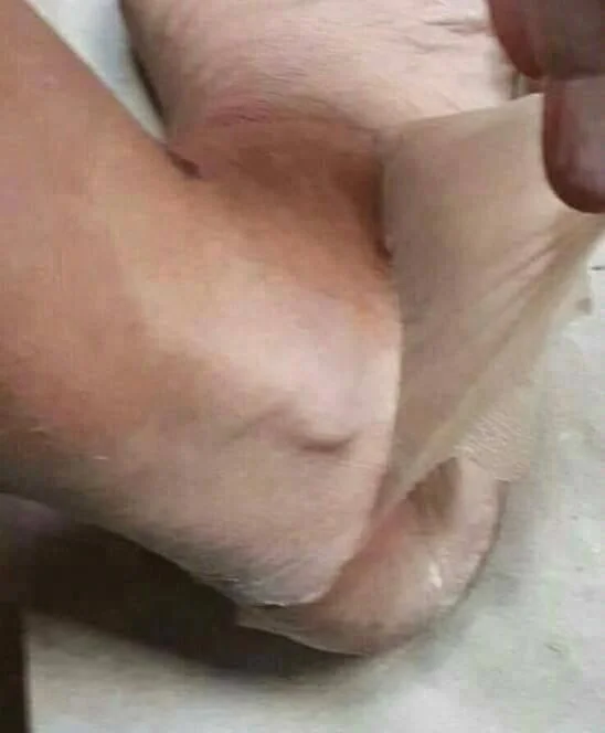 
Most Effective Yellow Peeling Oil 1 Liter Lowest Price 